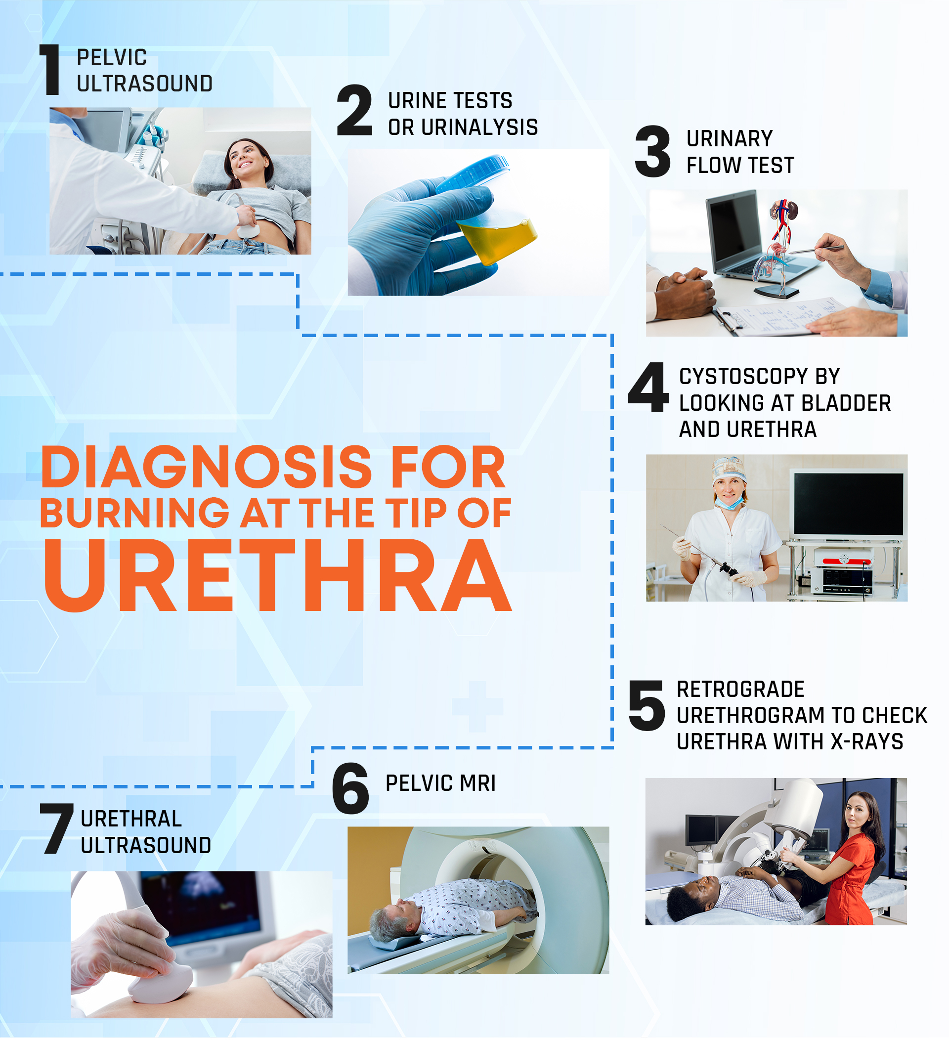 Diagnosis for Burning at the Tip of Urethra